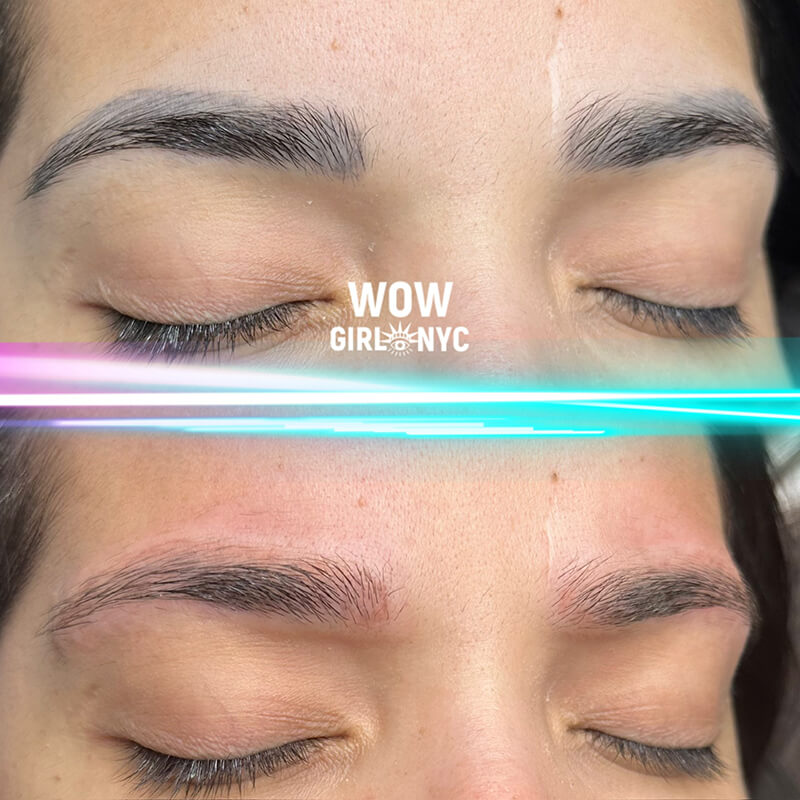 faded eyebrow PMU after laser removal New York