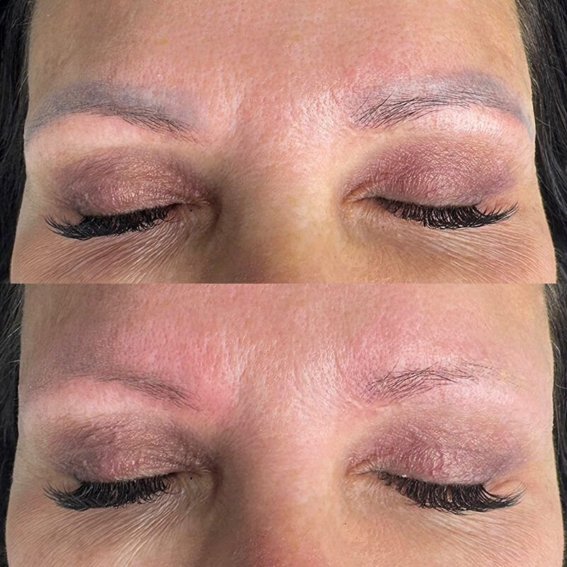 faded eyebrow PMU after laser removal New York