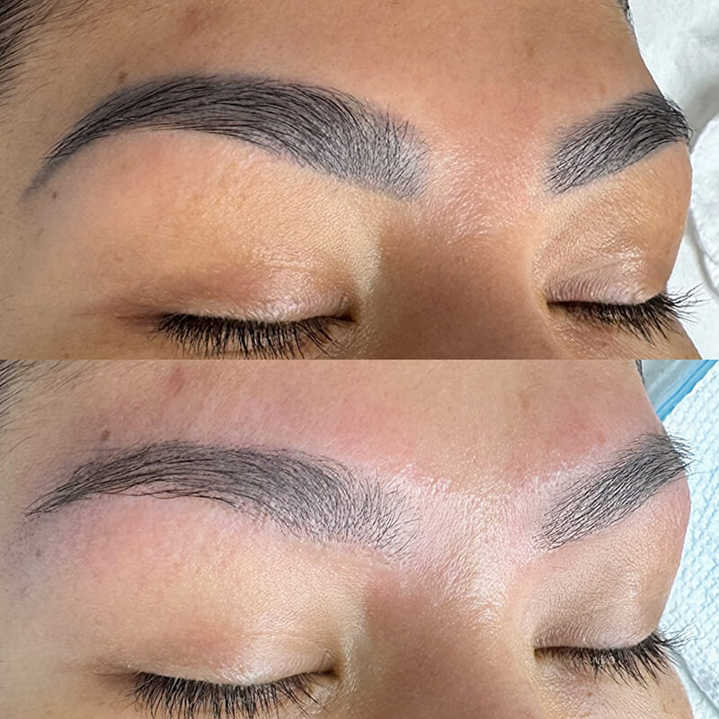 before after eyebrow PMU removal NYC