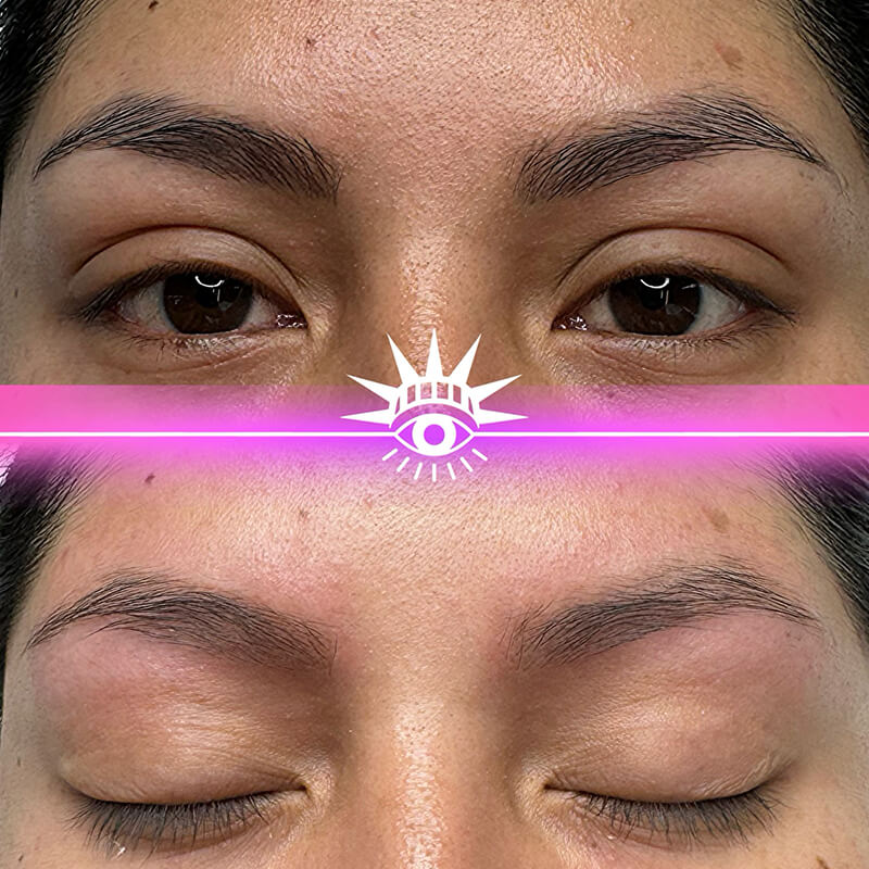 PMU eyebrow removal before after New York