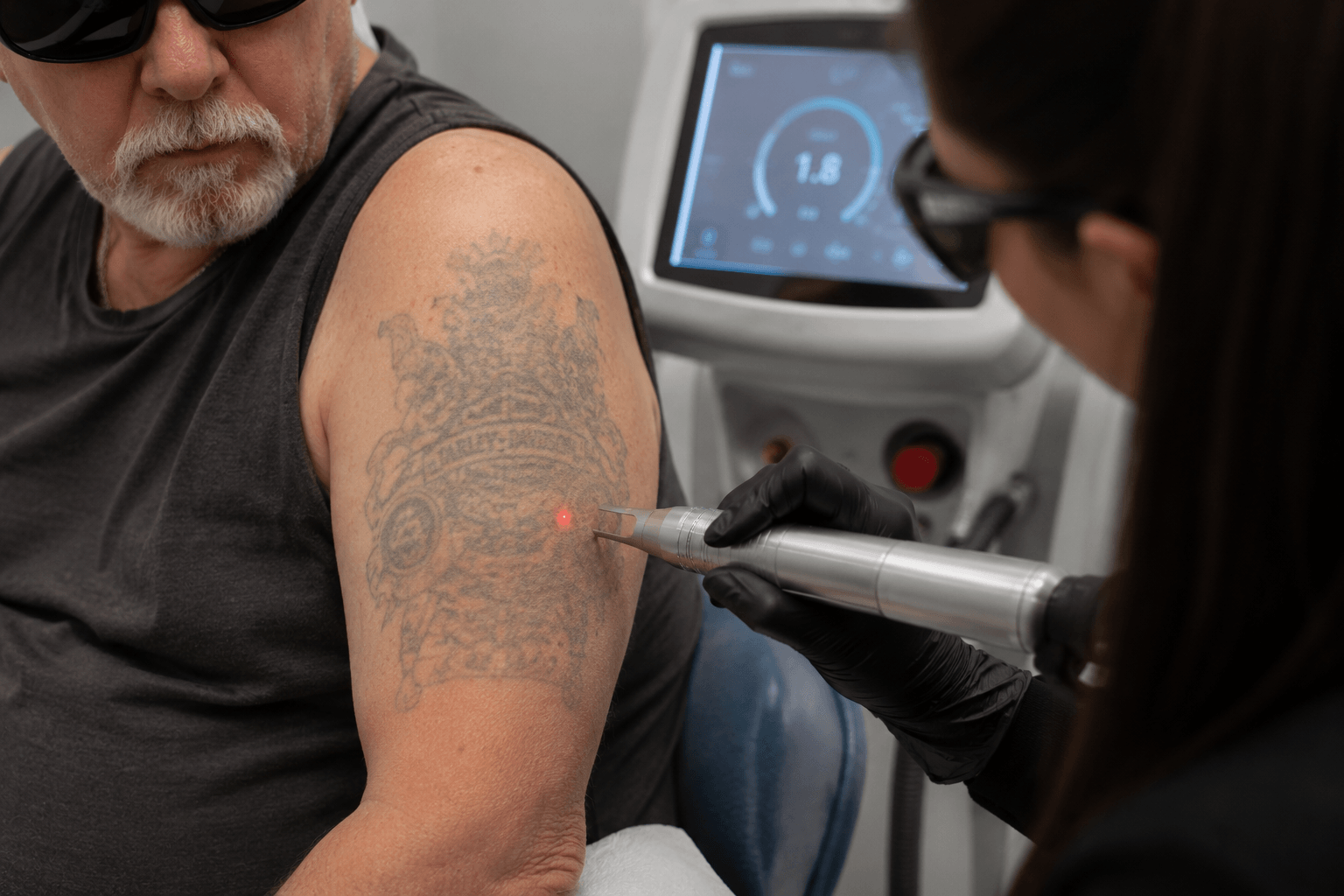 Thinking About Tattoo Removal in NYC