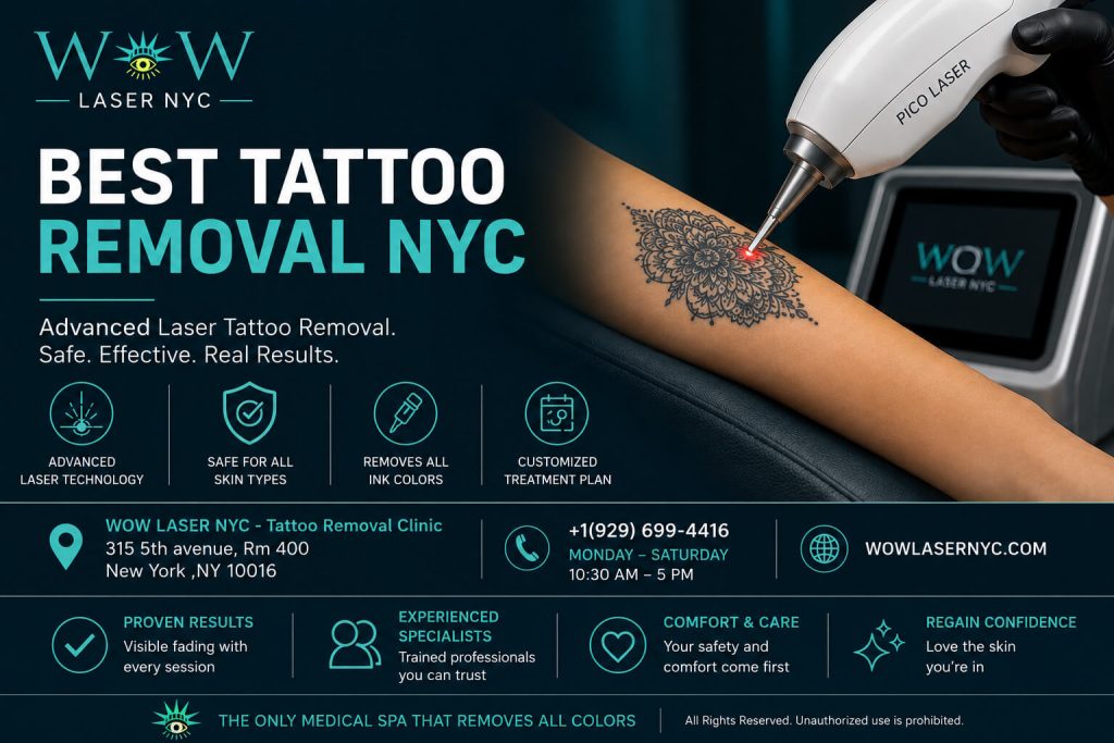 best tattoo removal nyc. new york